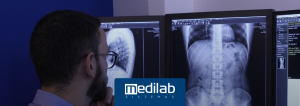Conheça os benefícios do software PACS com inteligência artificial da Medilab e transforme a gestão de imagens médicas com mais eficiência.